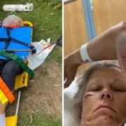 Ms Tvedt was airlifted to hospital suffering seven broken ribs, hoof marks on her chest and legs, a broken thumb, and life-changing severe internal injuries
